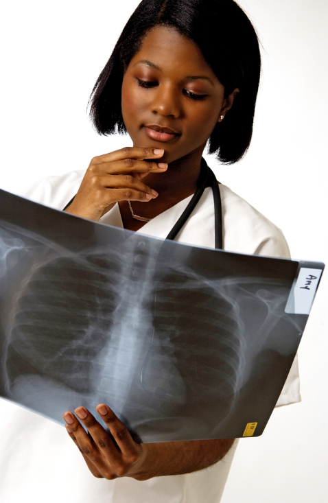 doctor lung x-ray