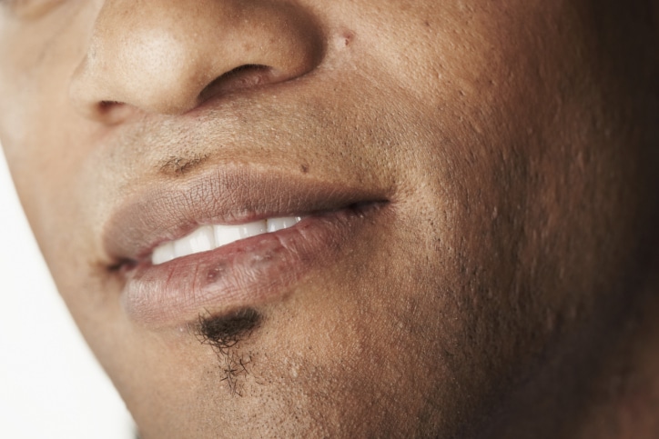 black people lips