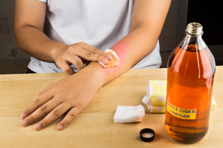 how to get rid of scars