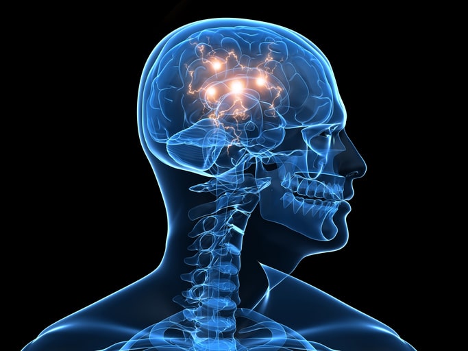 Tardive Dyskinesia