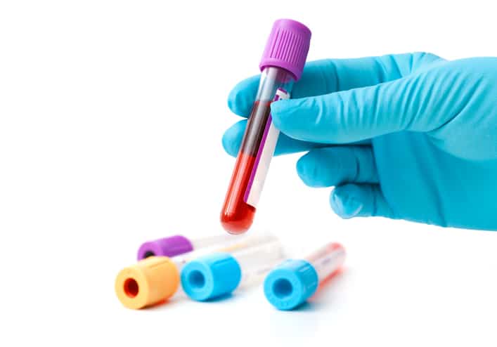 hand holding blood test