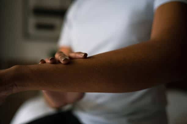 what is psoriasis