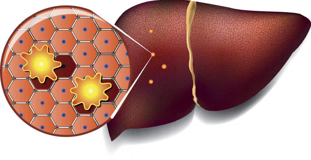 best foods for liver
