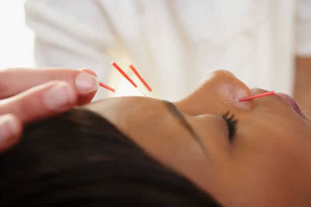 how to get rid of migraine