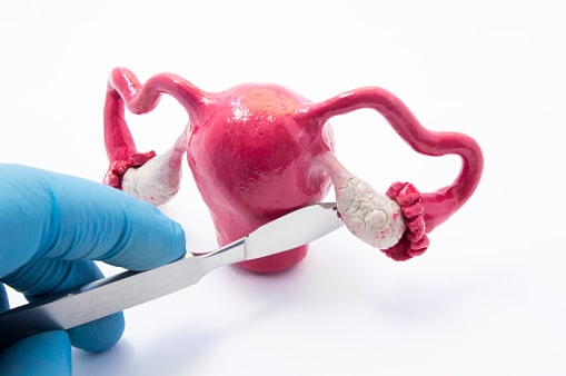 Ovarian Health
