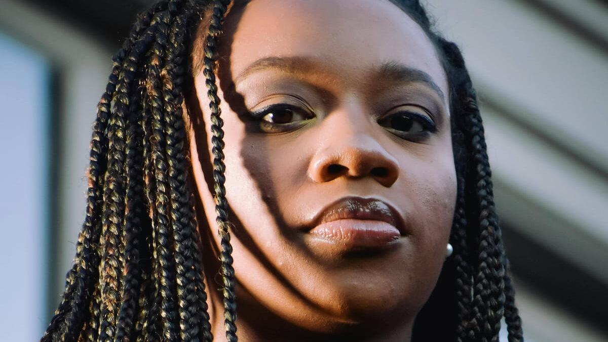 braids, traction alopecia