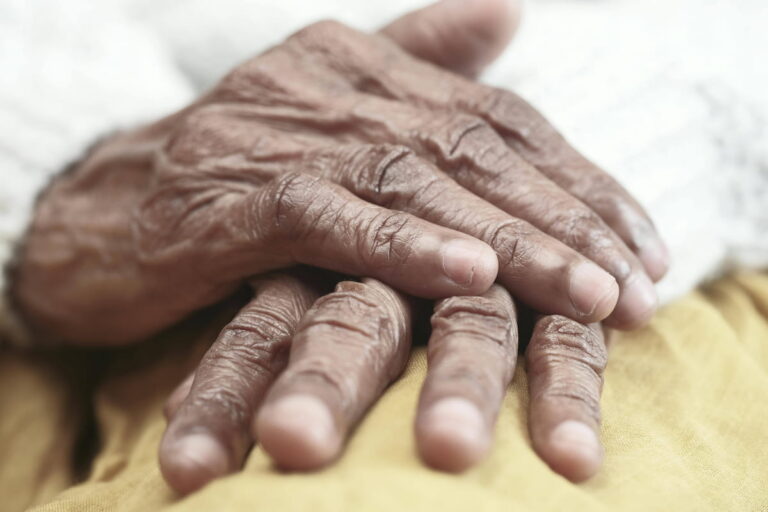 parkinsons disease, brain stimulation