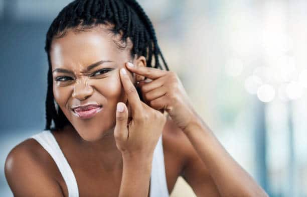 how to get rid of blackheads