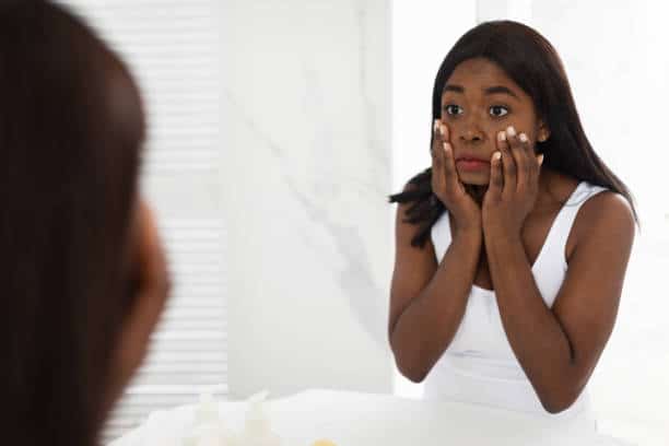 dry skin