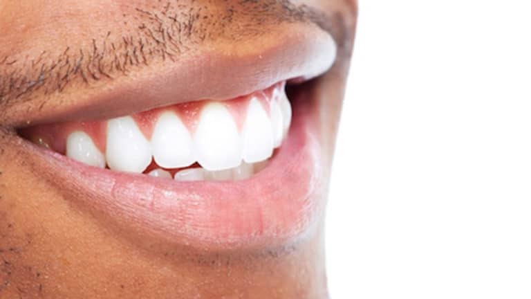 strong teeth gums