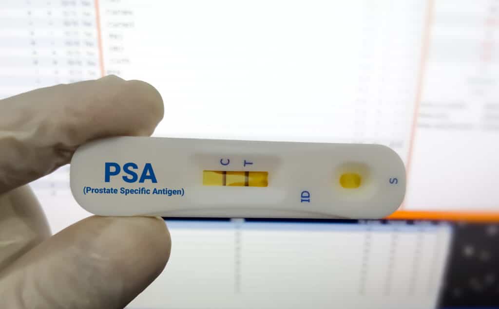 This Clinical Trial Showed Promise in Recurrent Prostate Cancer Patients