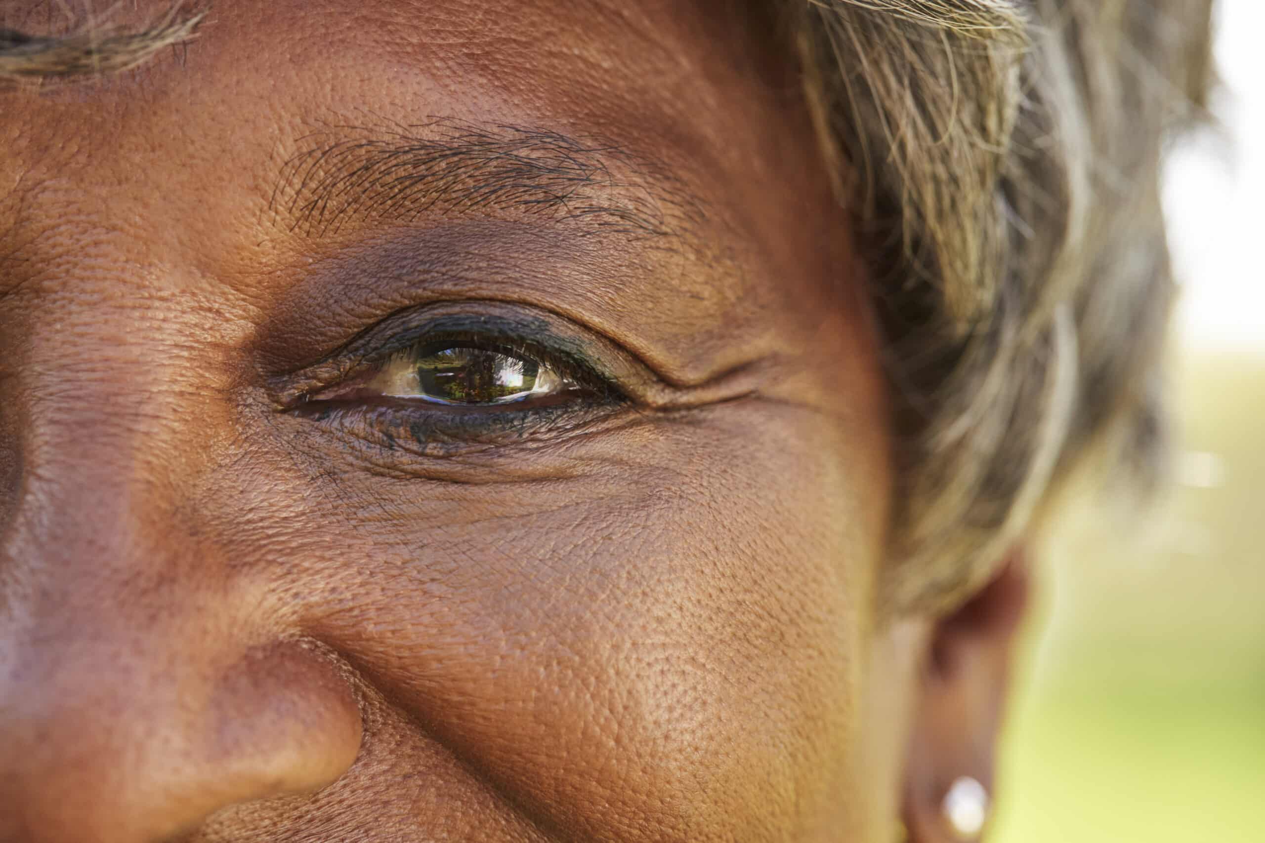 macular degeneration