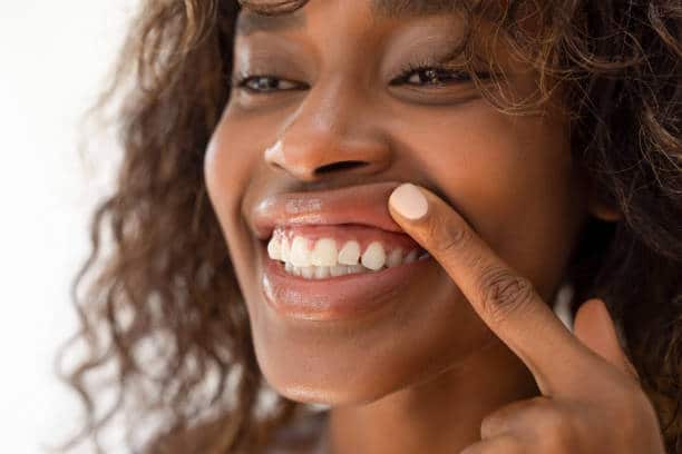unhealthy gums