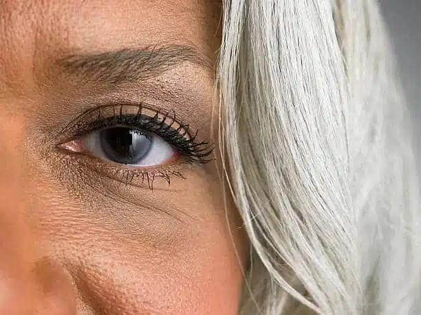 how to get rid of dark circles under eyes