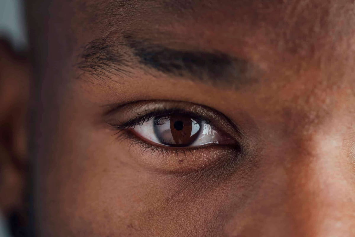 how to get rid of dark circles under eyes fast​