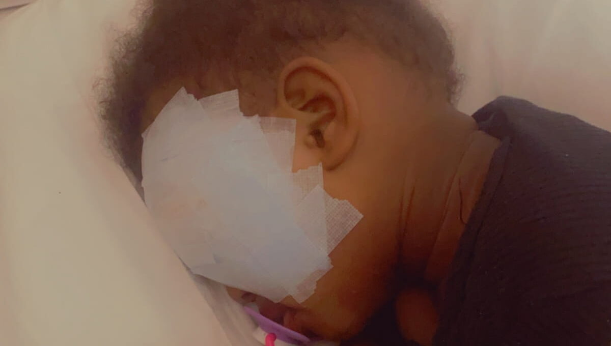 retinoblastoma
